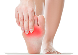 Neuroma (Morton's)