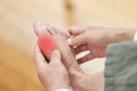 Easing the Agony of Gout in the Foot