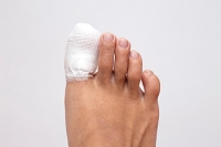 Common Reasons a Broken Toe Can Occur
